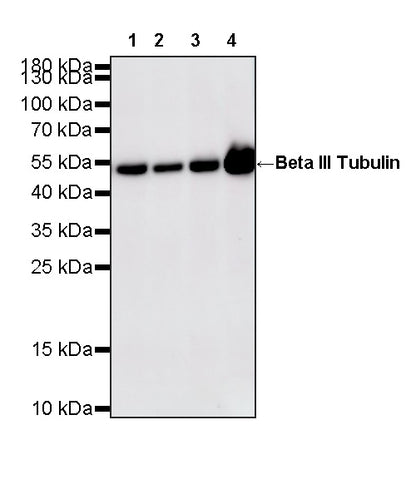 Beta III Tubulin Recombinant Rabbit mAb (S-5529)