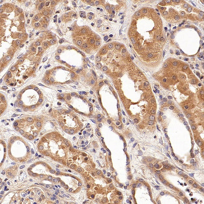 GDNF Receptor alpha 1/GFRA1 Recombinant Rabbit mAb (S-3289-52)