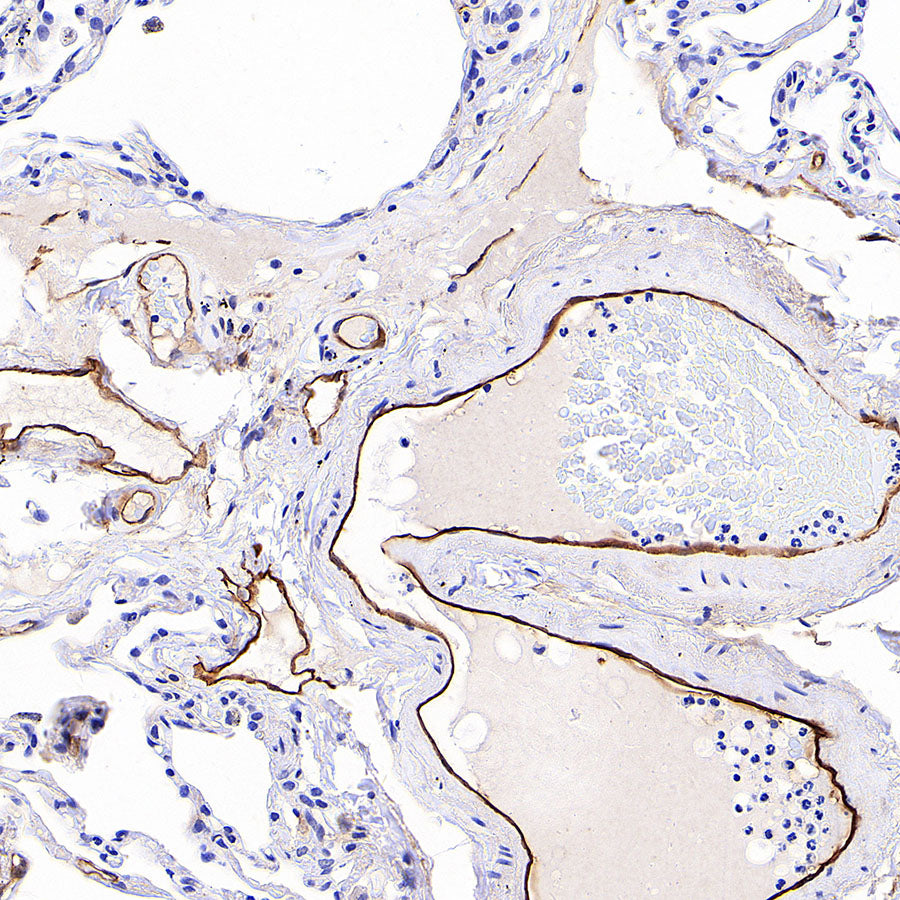 EPCR/PROCR (CD201) Rabbit Polyclonal Antibody