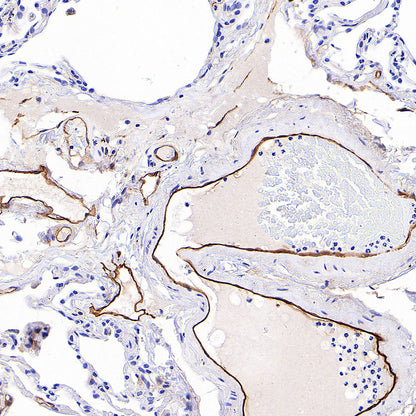 EPCR/PROCR (CD201) Rabbit Polyclonal Antibody
