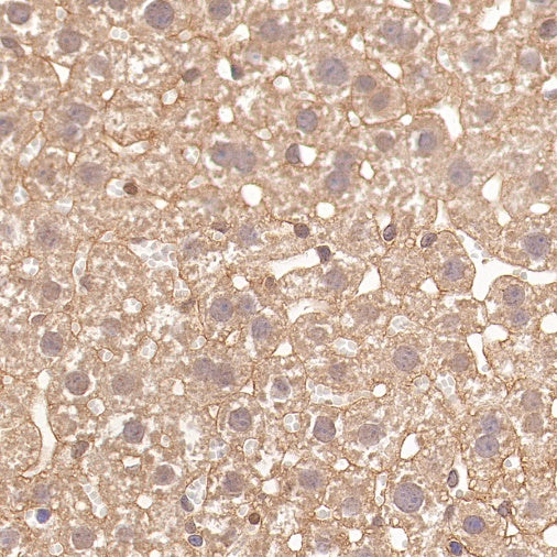 BRAF Recombinant Rabbit mAb (S-1328-60)