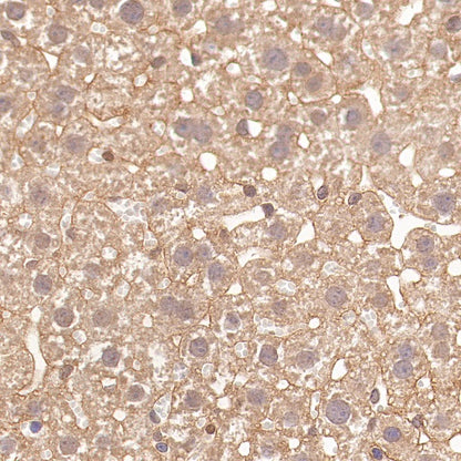 BRAF Recombinant Rabbit mAb (S-1328-60)