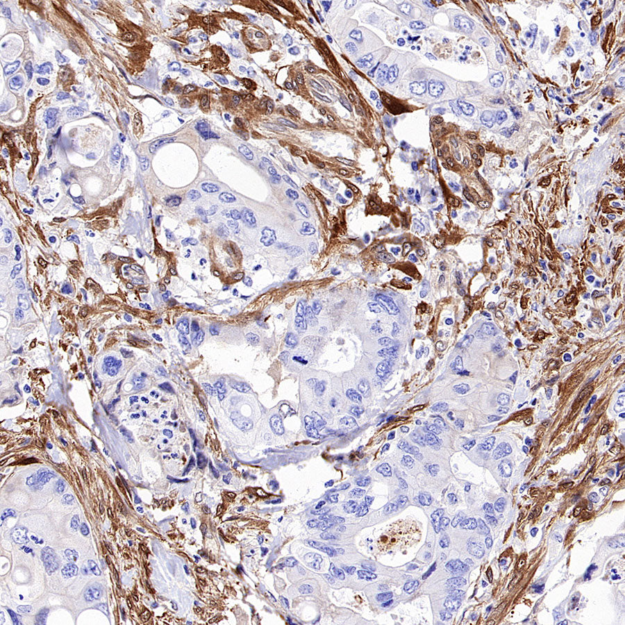 NNMT Recombinant Rabbit mAb (S-3470-58)