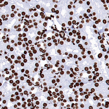 Histone H3 (di methyl K9) Recombinant Rabbit mAb (S-903-52)