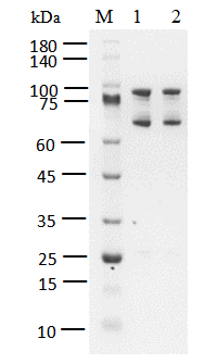 EGFR[T790M/C797S] Protein, Human