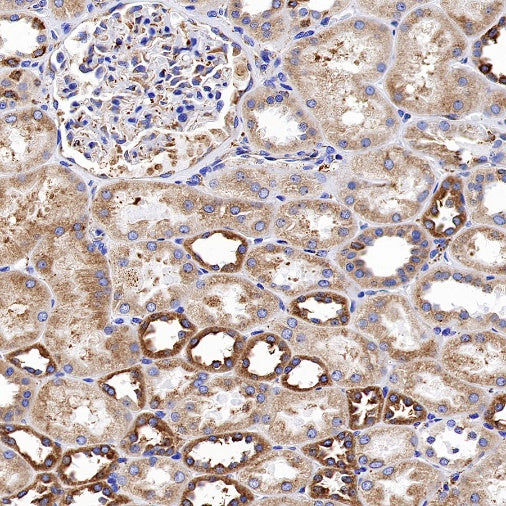 Calreticulin Recombinant Rabbit mAb (S-779-273)
