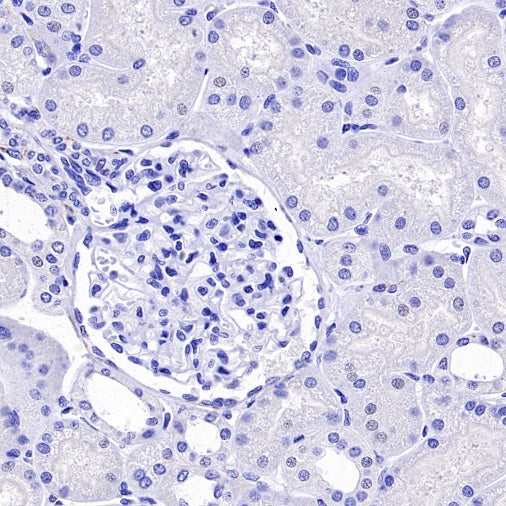 CD56 Recombinant Rabbit mAb (SDT-2427-1)