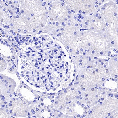 CD56 Recombinant Rabbit mAb (SDT-2427-1)