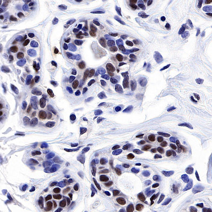TFEB Recombinant Rabbit mAb (S-R296)