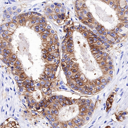 TACSTD2/TROP2 Recombinant Rabbit mAb (S-R238)