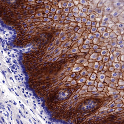 TACSTD2/TROP2 Recombinant Rabbit mAb (S-R238)