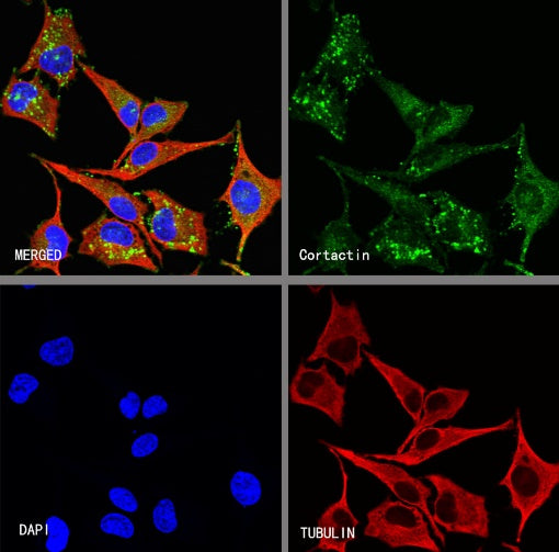 Cortactin Recombinant Rabbit mAb (S-1303-10)
