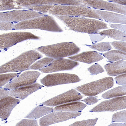 CACNA1S Recombinant Rabbit mAb (S-2448-78)