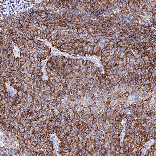 TRIM29 Recombinant Rabbit mAb (S-642-43)
