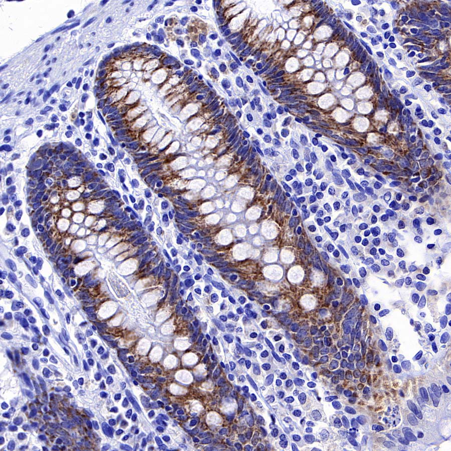 CHCHD10 Recombinant Rabbit mAb (S-4106-13)