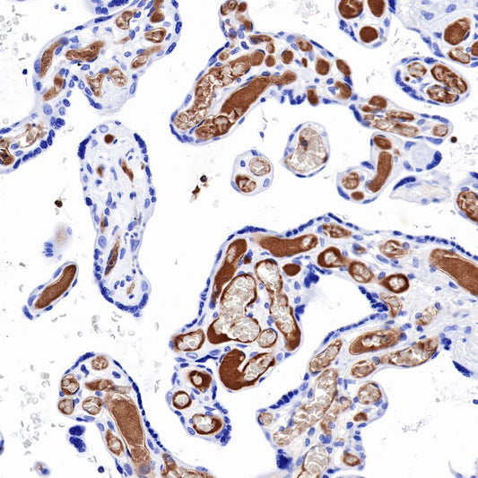 AFP Recombinant Rabbit mAb (SDT-R031)