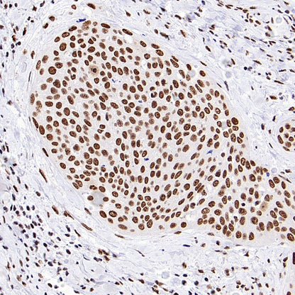 HSF1 Recombinant Rabbit mAb (S-3139-44)