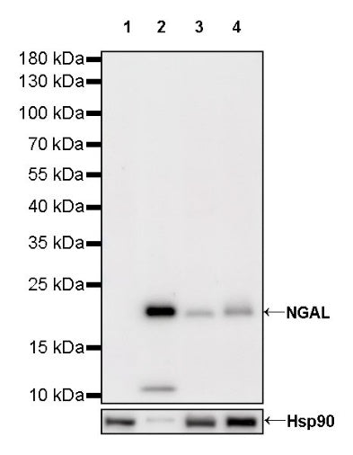 NGAL Recombinant Rabbit mAb (S-473-22)
