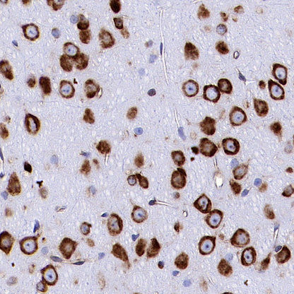 BID Recombinant Rabbit mAb (S-R300)