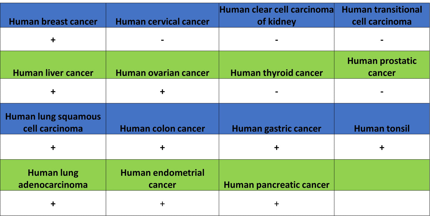 TIMP1 Recombinant Rabbit mAb (S-5147)