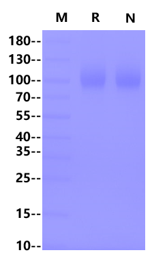gp130/CD130/IL-6 Rβ His Tag Protein, Human