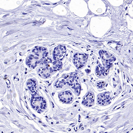 Claudin 9 Recombinant Rabbit mAb (S-2849-16)