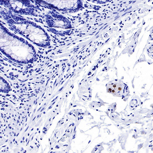 PHOX2B Recombinant Rabbit mAb (SDT-1142-21)