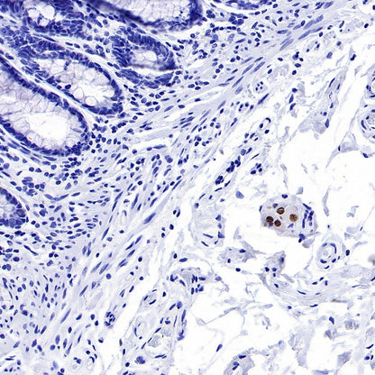PHOX2B Recombinant Rabbit mAb (SDT-1142-21)