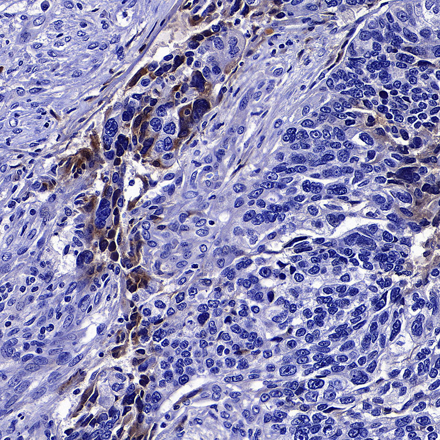 Factor XII (FXII) Recombinant Rabbit mAb (S-4487-31)