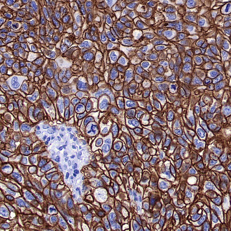 ALCAM Recombinant Rabbit mAb (S-4080-40)