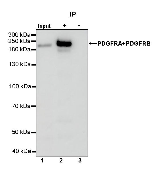 PDGFRA+PDGFRB Recombinant Rabbit mAb (S-393-11)