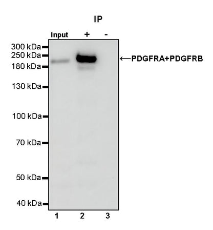 PDGFRA+PDGFRB Recombinant Rabbit mAb (S-393-11)