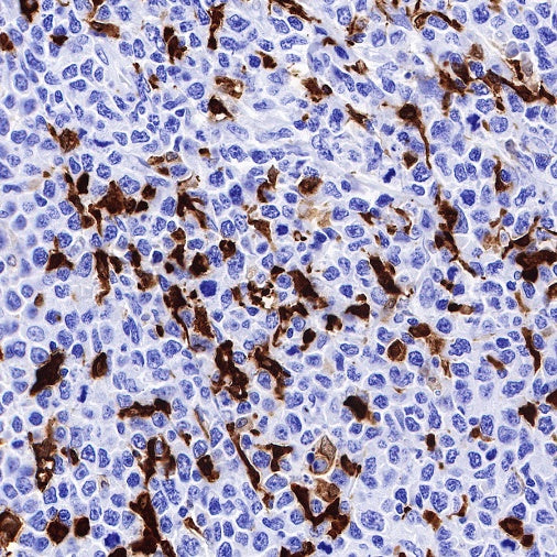 S100A8/MRP8 Recombinant Rabbit mAb (S-R251)