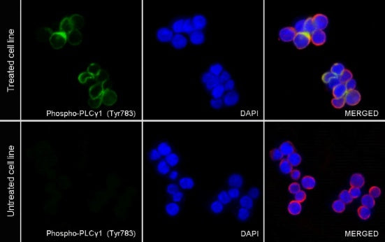 Phospho-PLCγ1 (Tyr783) Recombinant Rabbit mAb (S-1184-12)