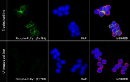 Phospho-PLCγ1 (Tyr783) Recombinant Rabbit mAb (S-1184-12)