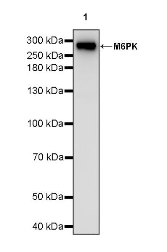 M6PR Recombinant Rabbit mAb (S-1480-21)