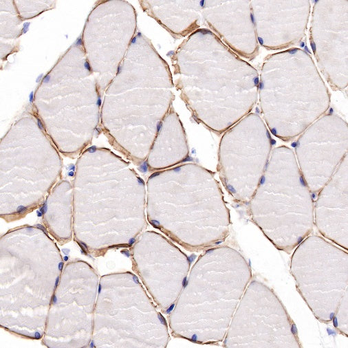 Dystrophin Recombinant Rabbit mAb (S-090-327)