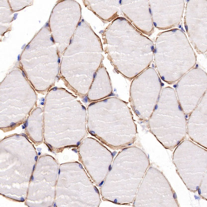 Dystrophin Recombinant Rabbit mAb (S-090-327)