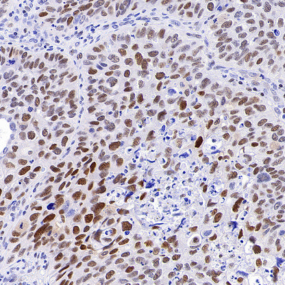 PAPSS1 Recombinant Rabbit mAb (S-3516-23)