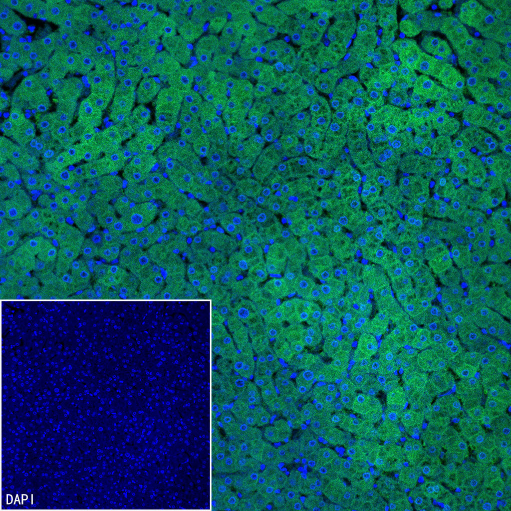 Pklr Recombinant Rabbit mAb (S-4114-40)