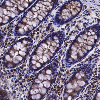 β-tubulin Recombinant Rabbit mAb (SDT-312-113)