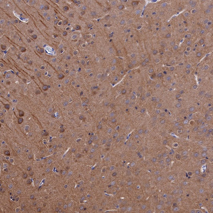 LC3B Recombinant Rabbit mAb (S-477-89)