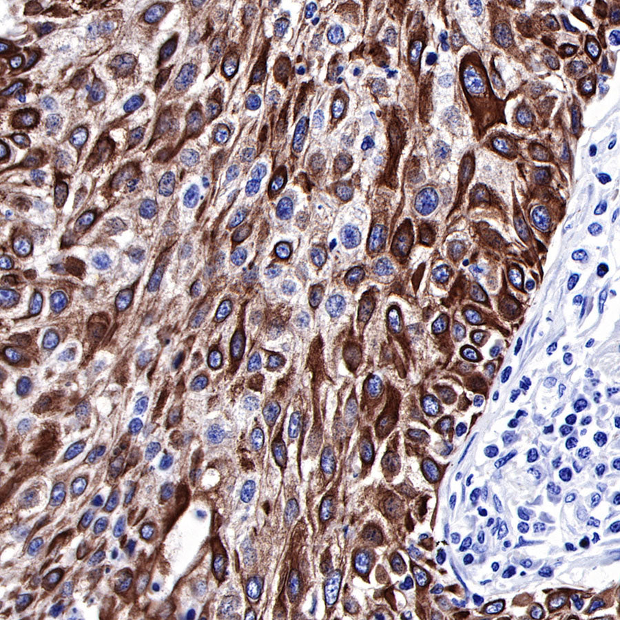 keratin 6 Rabbit mAb (SDT-015-69)
