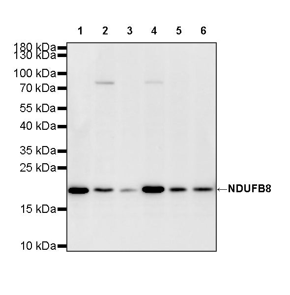 NDUFB8 Recombinant Rabbit mAb (S-4770-29)