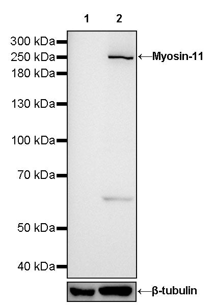 Myosin-11/SMMHC Recombinant Rabbit mAb,PBS Only (SDT-188-112)