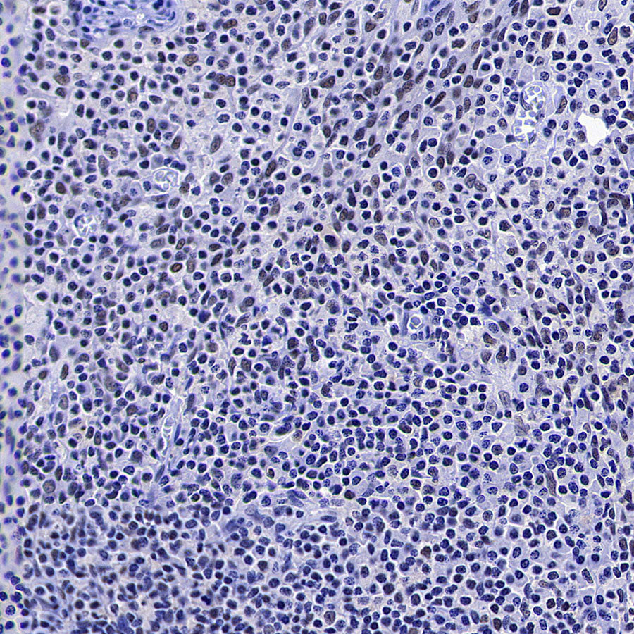 OGT Mouse mAb