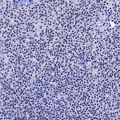 OGT Mouse mAb