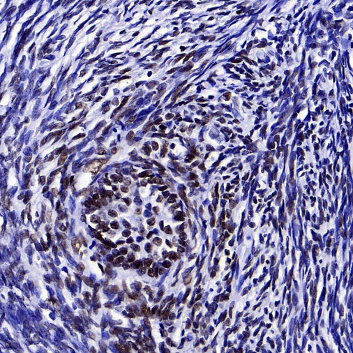 FOXL2 Recombinant Rabbit mAb (SDT-557-361)