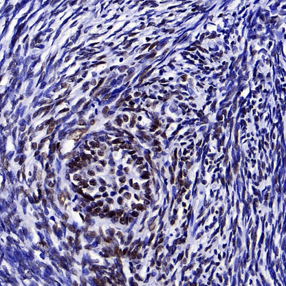 FOXL2 Recombinant Rabbit mAb (SDT-557-361)