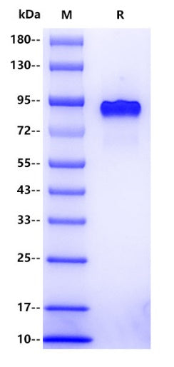 Human Progranulin Protein, His tag